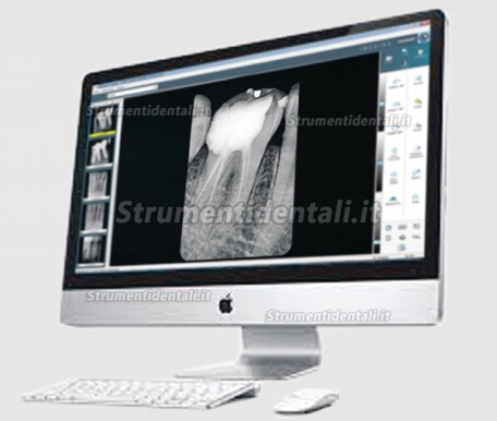 VISIODENT® RSV4 Sensore intraorale per radiografia dentale mappa