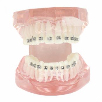 Malocclusione Modello corretto con 20 Brackets M-3001