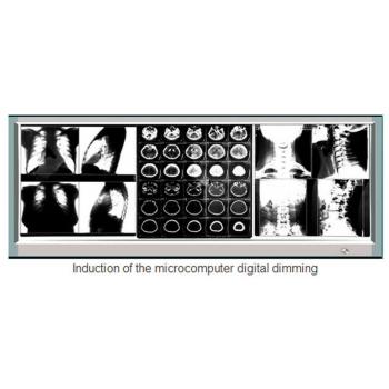 Visualizzatore di Film Ultra-sottileb a Raggi x Illuminatore LED Medico Diagnostico View Box 1100H