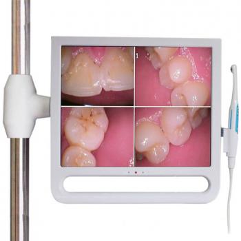 Telecamera intraorale dentale Magenta YF1700M con schermo da 17 pollici e WIFI