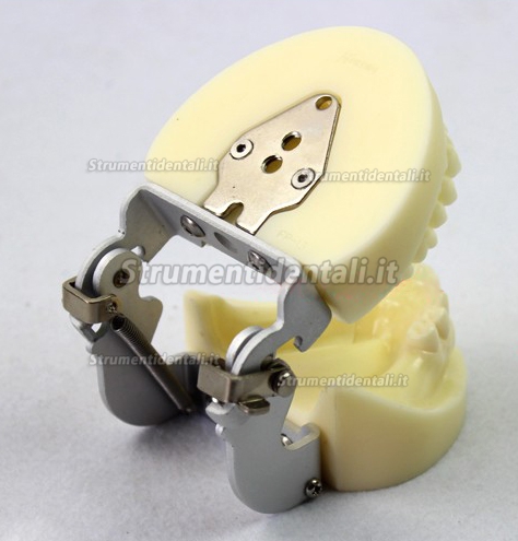 ENOVO Modello esercizio impianto dentale con protesi rimovibile