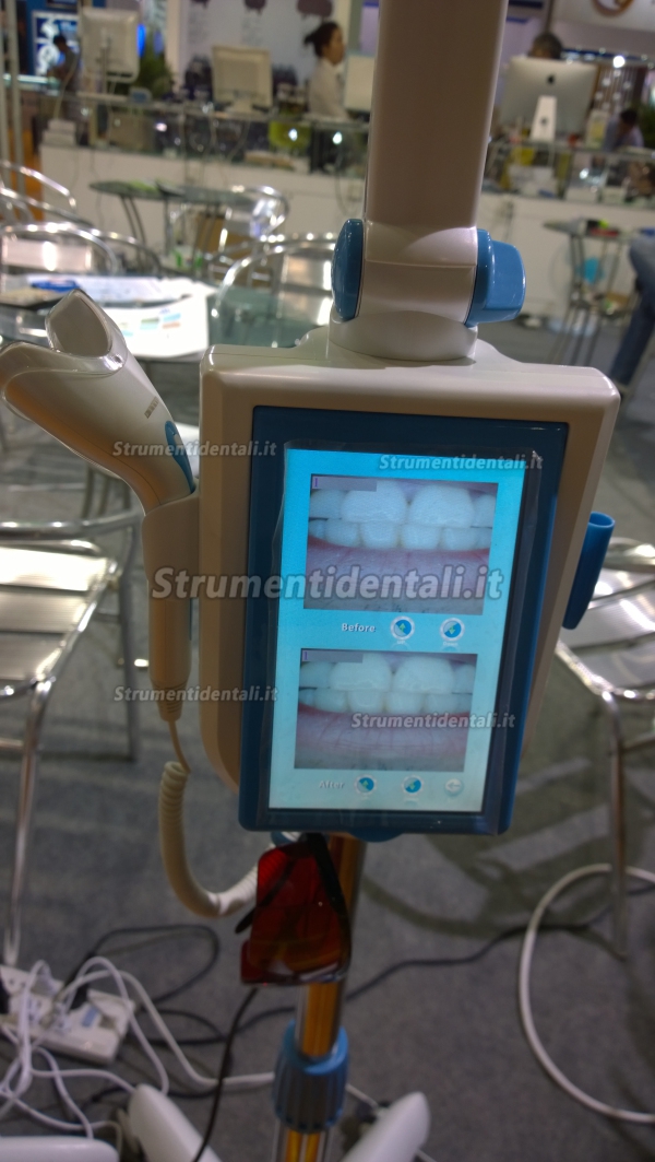 Magenta® MD-887B Lampade sbiancamento dentale touch screen da 7inch éSchermo con caméra