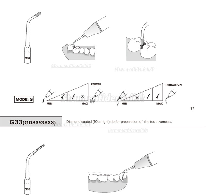 5Pz Refine® Inserti piezo per endodonzia G20 G21 G30 G31 G32 G33 G35 compatible con REFINE EMS Woodpecker