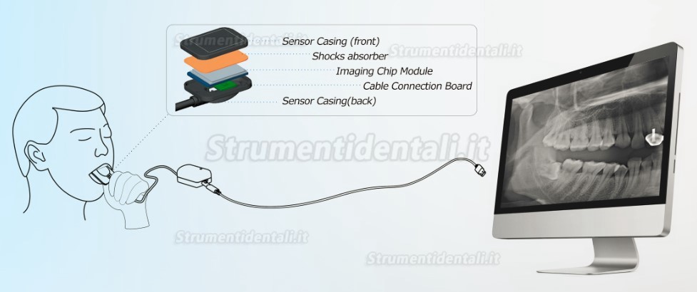 Sensori digitali usb dentale (con 500pz protezioni per sensori + centratori per radiografie)