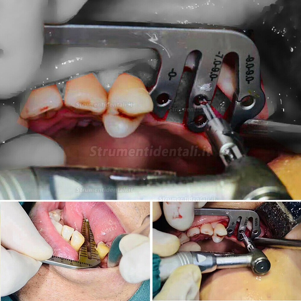 Calibro flessibile per impianto (Strumento per guida di perforazione ​chirurgica L&S)