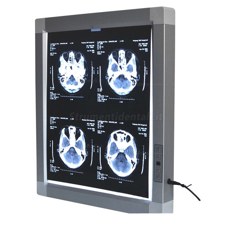 Visualizzatore medico JINDETECH X Raggi Film Diagnostico E.N.T Illuminatore LED View Box Visualizzatore medico JINDETECH X Raggi Film Diagnostico E.N.T Illuminatore LED View Box