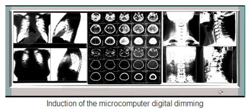 Visualizzatore di Film Ultra-sottileb a Raggi x Illuminatore LED Medico Diagnostico View Box 1100H
