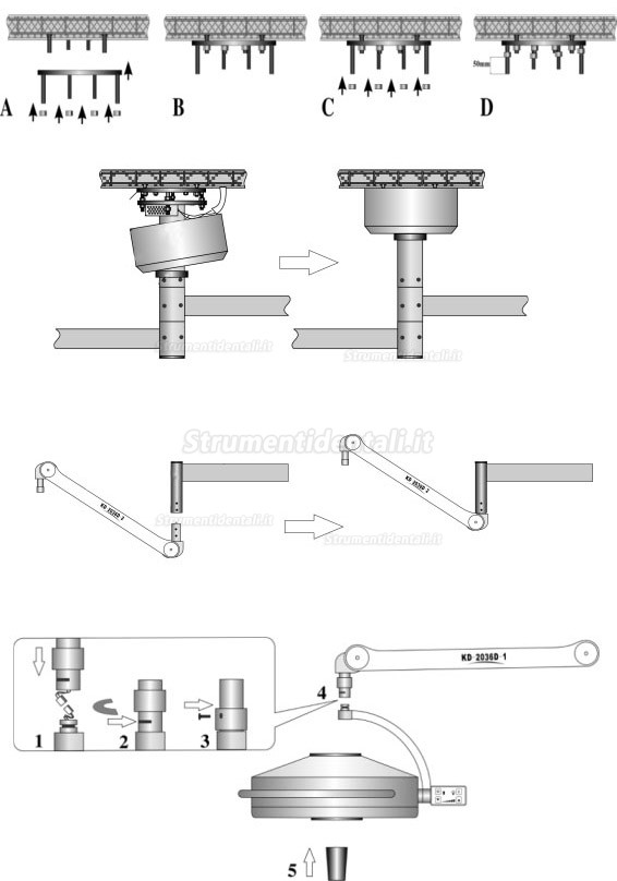 KD-2036D-2 36LED Lampada scialitica odontoiatrico con profondità di illuminazione regolabile (a soffitto)