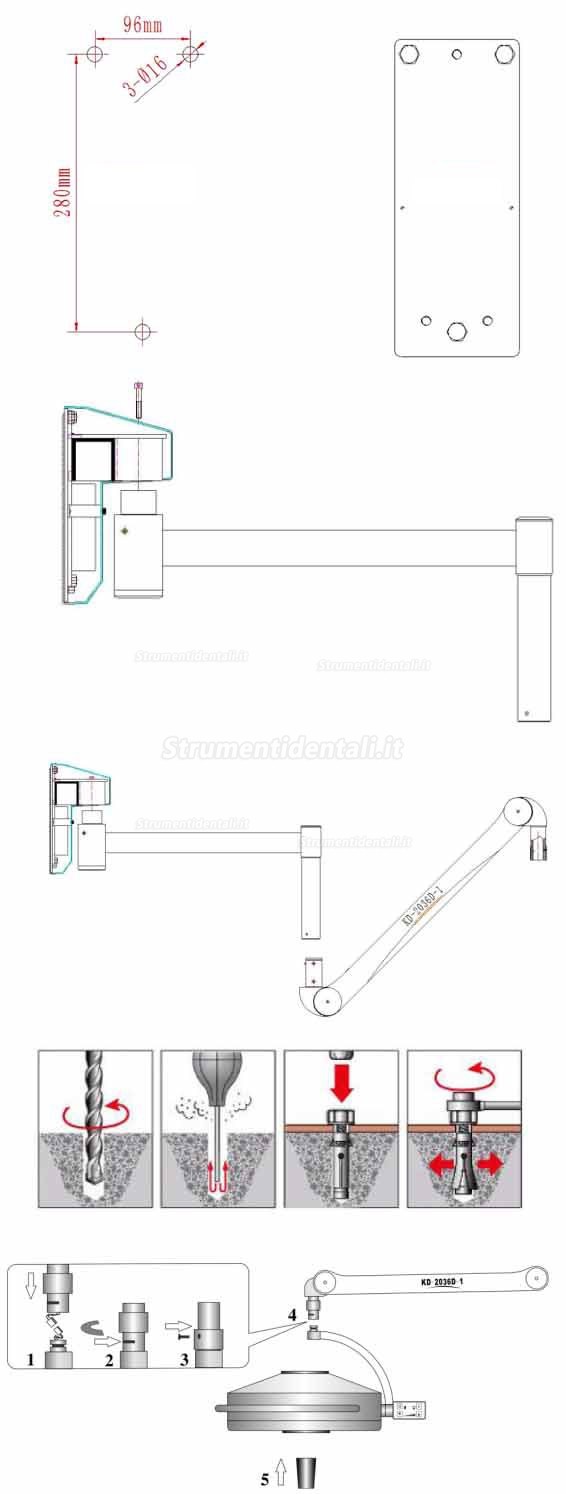 KD-2036D-2 36LED Lampada scialitica odontoiatrico con profondità di illuminazione regolabile (a muro)