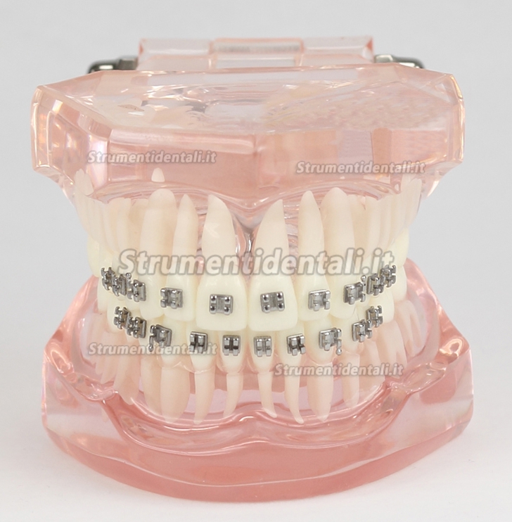 Malocclusione Modello corretto con 20 Brackets M-3001