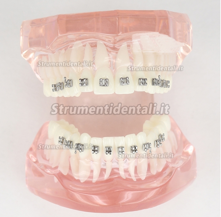 Malocclusione Modello corretto con 20 Brackets M-3001