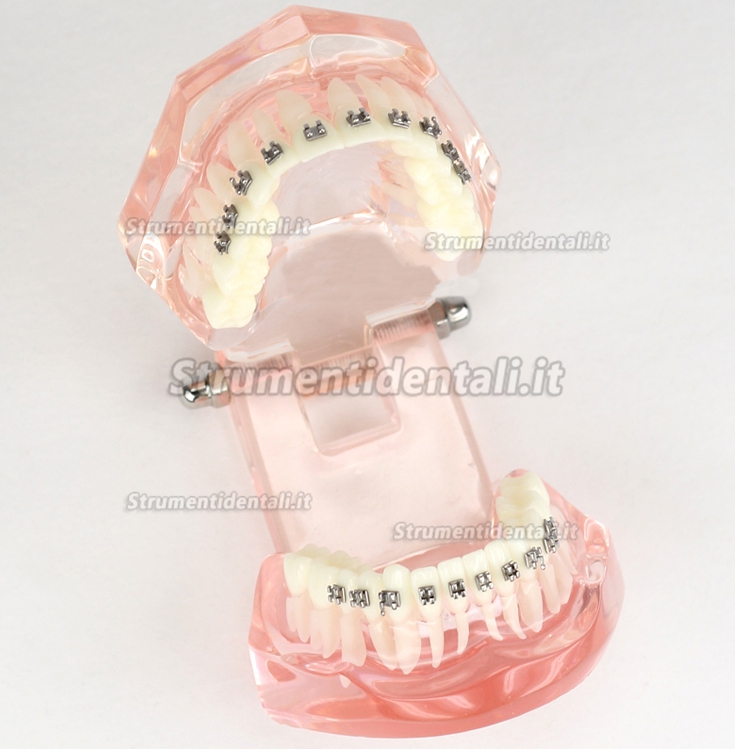 Malocclusione Modello corretto con 20 Brackets M-3001