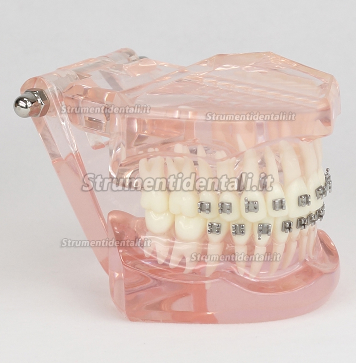 Malocclusione Modello corretto con 20 Brackets M-3001