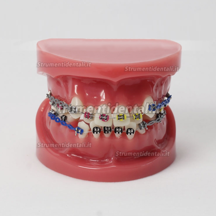 Modello ortodontico con arco esterno M-3005