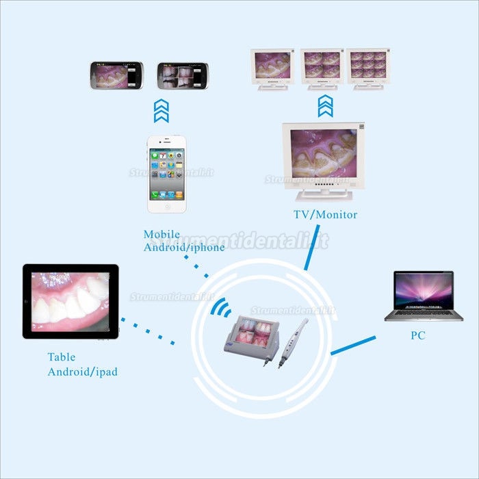 Dentale Cablato Telecamera Intraorale CF-988A WI-FI con Display LCD da 8 Pollici Telecamera M-868 Dentale Cablato Telecamera Intraorale CF-988A WI-FI con Display LCD da 8 Pollici Telecamera M-868