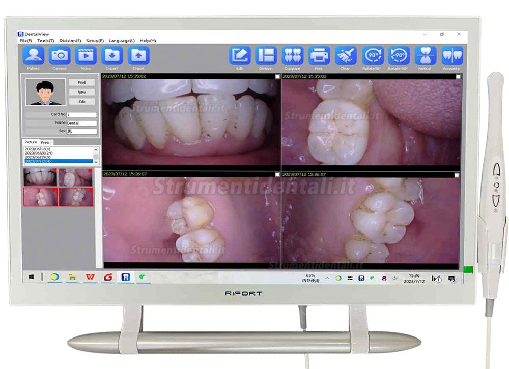Telecamera intraorale dentale magenta YF-2200P+ con touch screen da 21,5 pollici