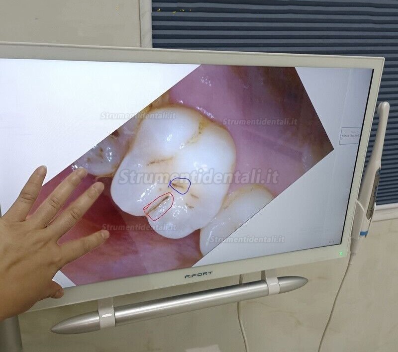 Telecamera intraorale dentale magenta YF-2200P+ con touch screen da 21,5 pollici