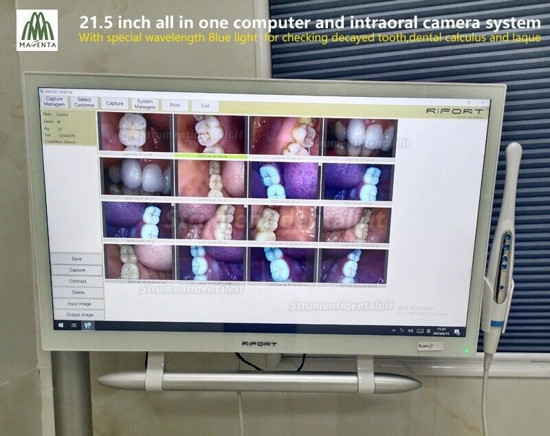 Telecamera intraorale dentale magenta YF-2200P+ con touch screen da 21,5 pollici Telecamera intraorale dentale magenta YF-2200P+ con touch screen da 21,5 pollici