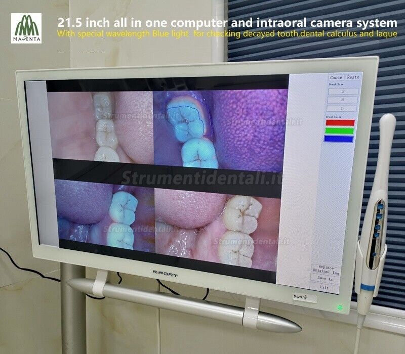 Telecamera intraorale dentale magenta YF-2200P+ con touch screen da 21,5 pollici