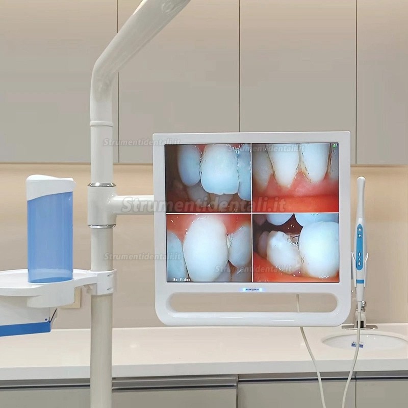 Telecamera intraorale dentale Magenta YF1700M con schermo da 17 pollici e WIFI