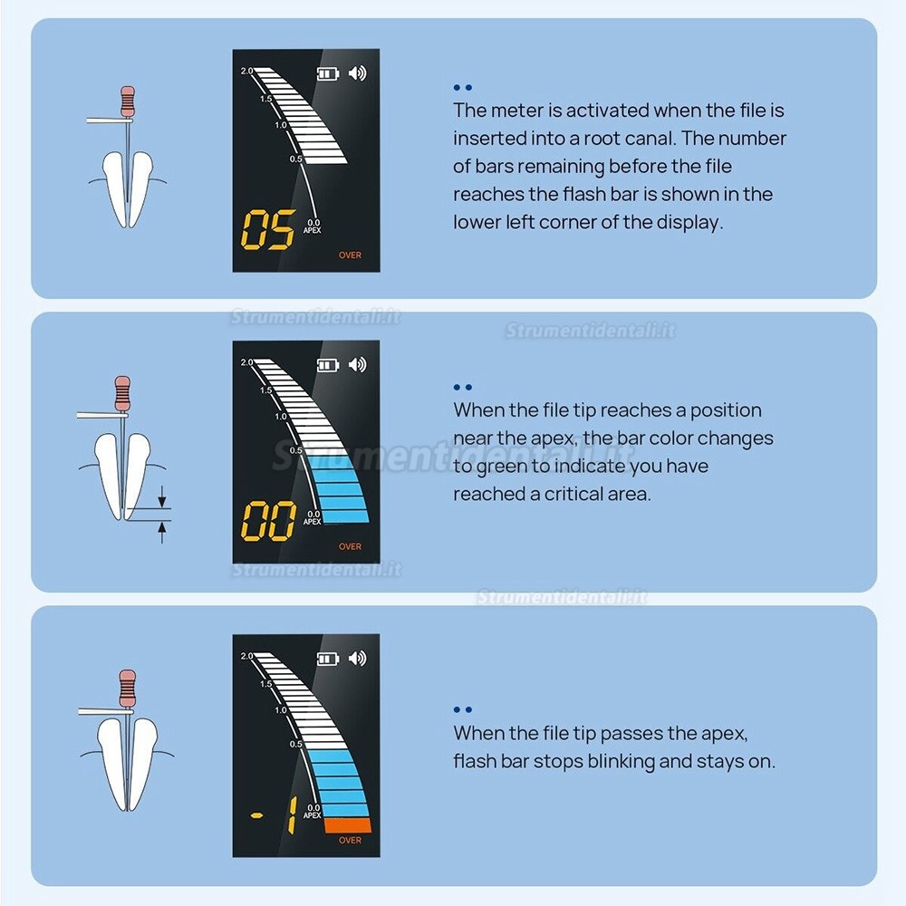 Rilevatore apicale endodonzia dente, localizzatore apicale endodonzia Micropex Pro Rilevatore apicale endodonzia dente, localizzatore apicale endodonzia Micropex Pro