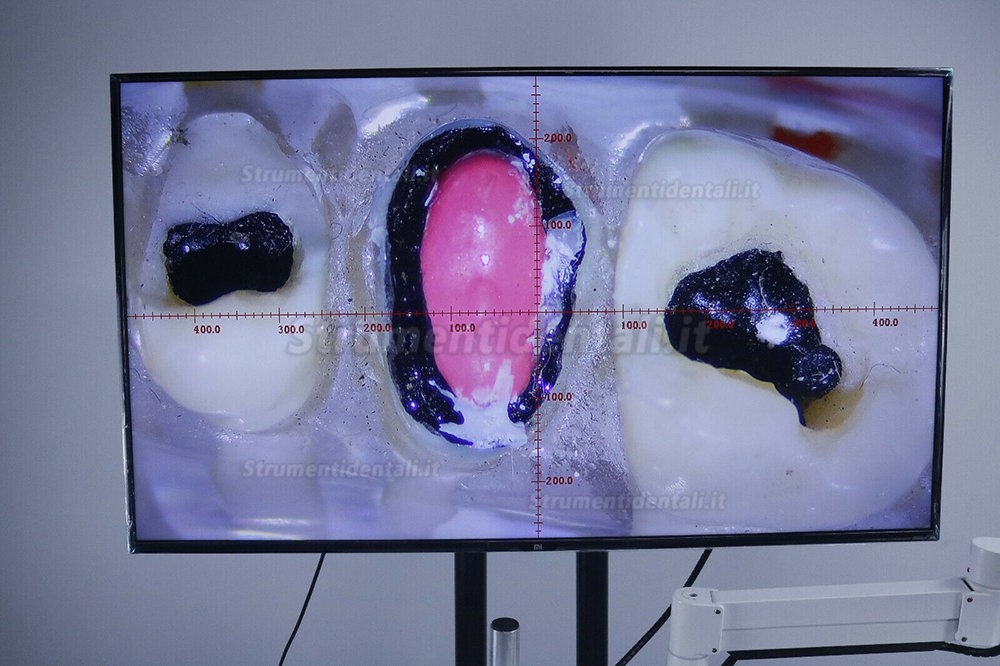 Microscopio operatorio odontoiatrico con telecamera per poltrona odontoiatrica