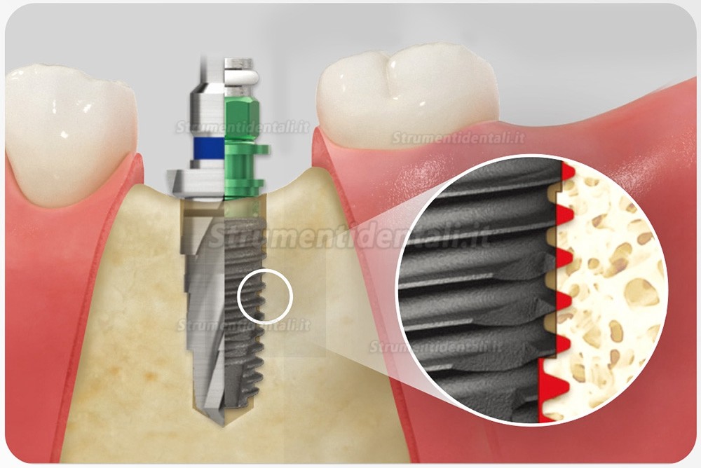 Kit chirurgico conico Osstem Hiossen con chiave dinamometrica  (Utilizzare per TSⅢ/Ⅳ SSⅢ USⅢ/Ⅳ)