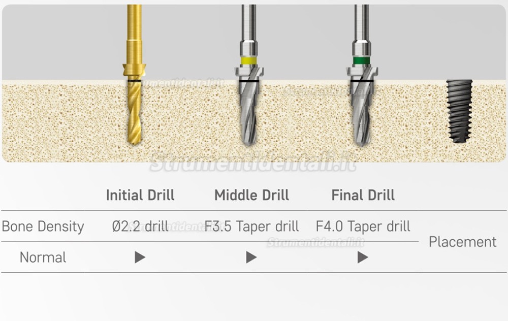 Kit chirurgico conico Osstem Hiossen con chiave dinamometrica  (Utilizzare per TSⅢ/Ⅳ SSⅢ USⅢ/Ⅳ)