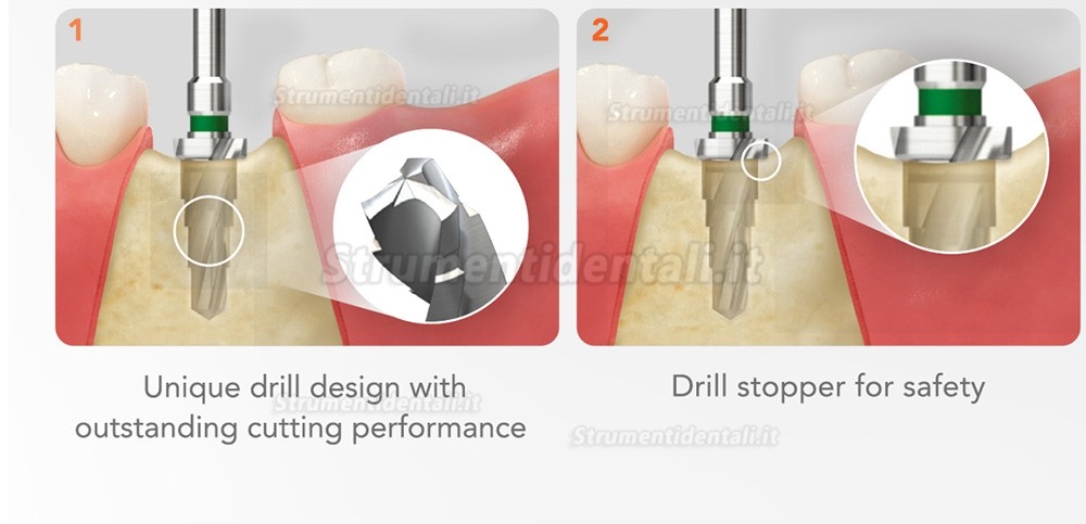 Kit chirurgico conico Osstem Hiossen con chiave dinamometrica  (Utilizzare per TSⅢ/Ⅳ SSⅢ USⅢ/Ⅳ)