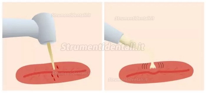 Attrezzature per la chirurgia piezoelettrica odontoiatria Refine MaxSurgery Attrezzature per la chirurgia piezoelettrica odontoiatria Refine MaxSurgery