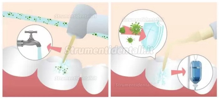 Attrezzature per la chirurgia piezoelettrica odontoiatria Refine MaxSurgery Attrezzature per la chirurgia piezoelettrica odontoiatria Refine MaxSurgery