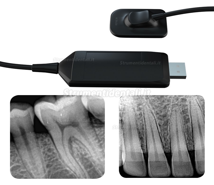 Refine R1/R2 sensori dentale sensori intraorali digitali portatili USB