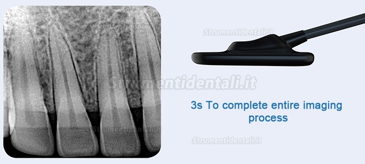 Refine R1/R2 sensori dentale sensori intraorali digitali portatili USB