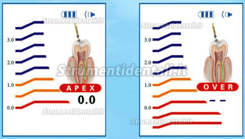 ZP® SR-100 Rilevatore apicale in Colour