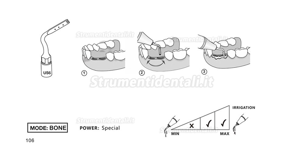 1Pz Inserti Piezomed Per La Chirurgia Ossea US1 US1L US1R US2 US3 US4 US5 US6 US7 US11 US12 Compatible Con Mectron, Silfradent, Dmetec e Woodpecker