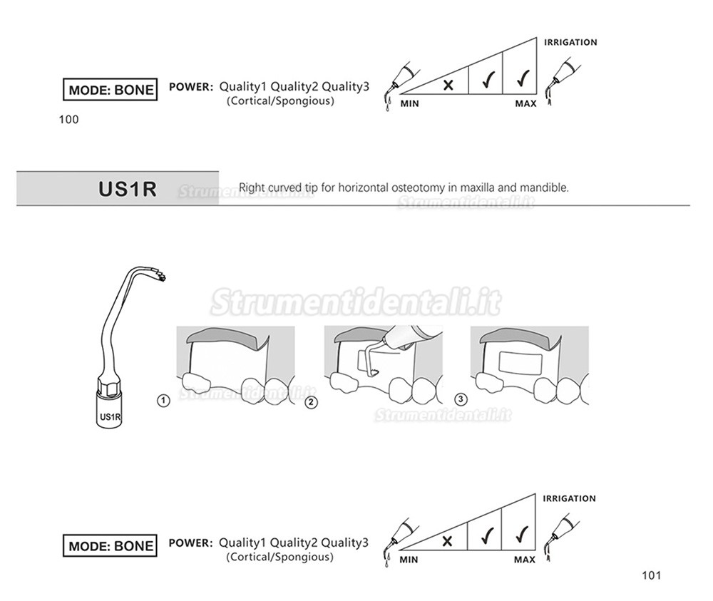 1Pz Inserti Piezomed Per La Chirurgia Ossea US1 US1L US1R US2 US3 US4 US5 US6 US7 US11 US12 Compatible Con Mectron, Silfradent, Dmetec e Woodpecker