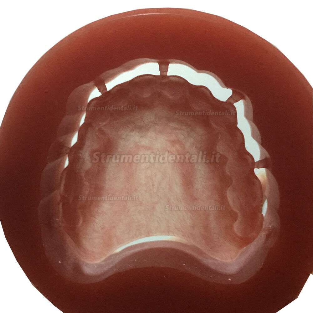 5 pezzi dischi in pmma 98mm dentale con iniettato di sangue (fresatrice del sistema CAD/CAM Wieland)