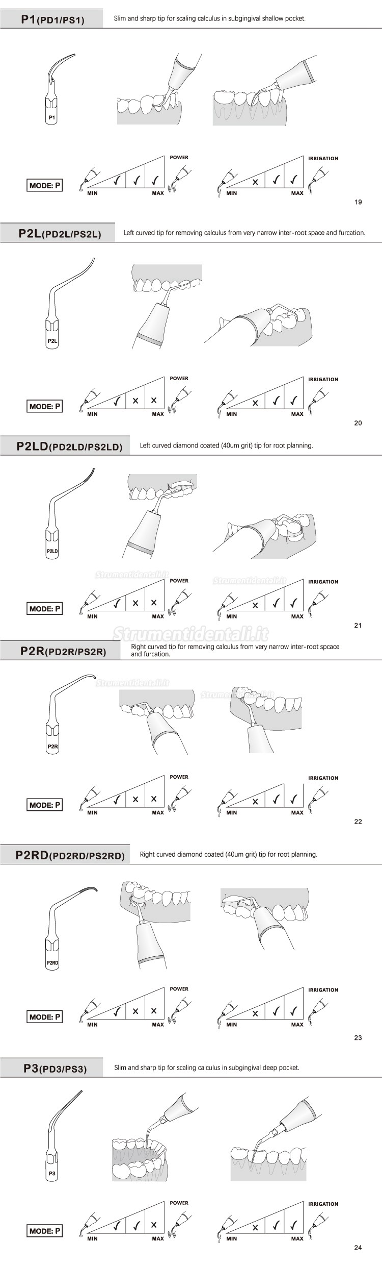 5Pz Refine® Inserti Piezo Per Parodontologia P2L P2R P2LD P2RD P5 P6 P7 P8 P10 P11 P12 P14L Compatible Con EMS Woodpecker
