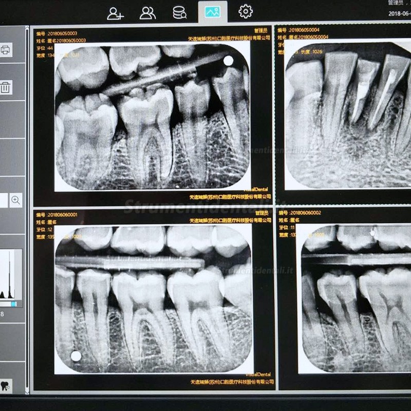 TYRIS TR-200 dentale digitale scanner ai fosfori sistemi ai fosfori con touch screen a colori reali