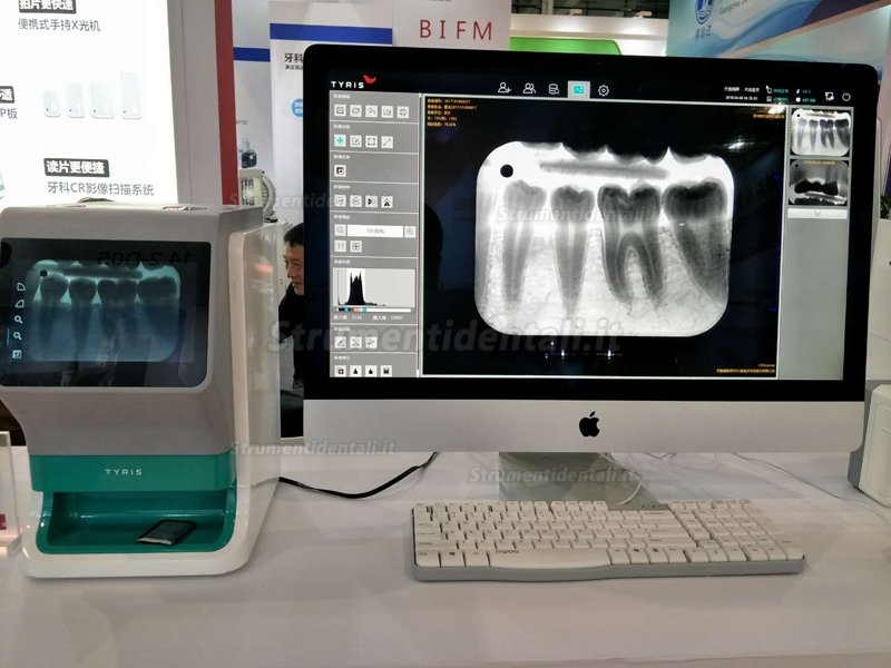 TYRIS TR-200 dentale digitale scanner ai fosfori sistemi ai fosfori con touch screen a colori reali