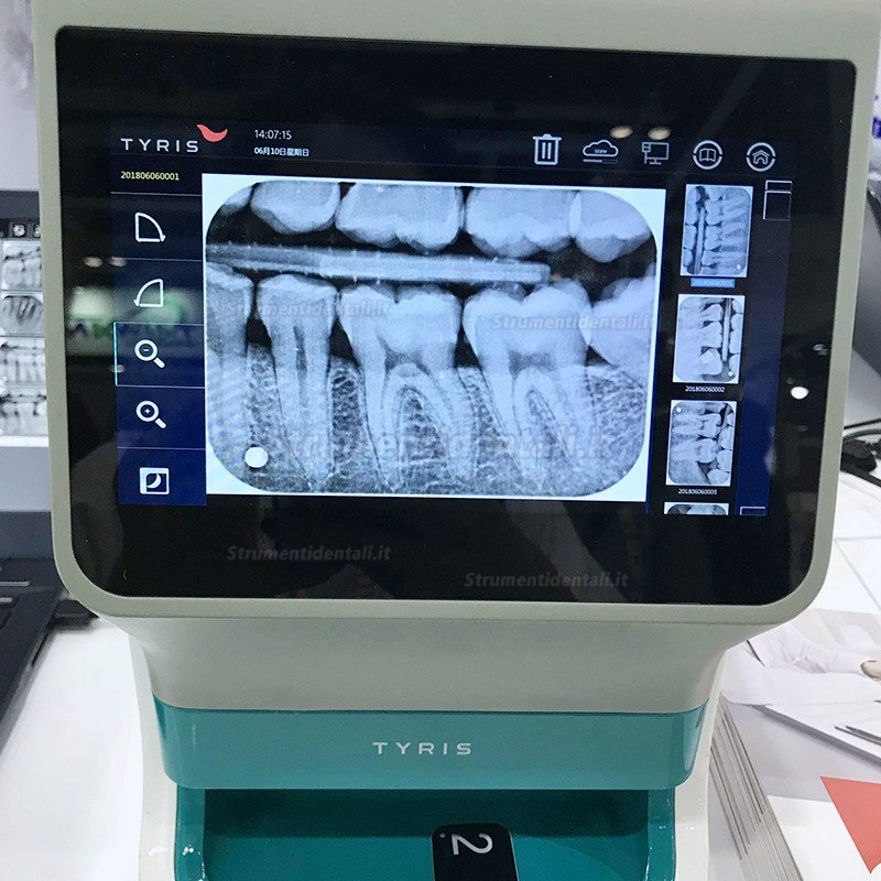 TYRIS TR-200 dentale digitale scanner ai fosfori sistemi ai fosfori con touch screen a colori reali