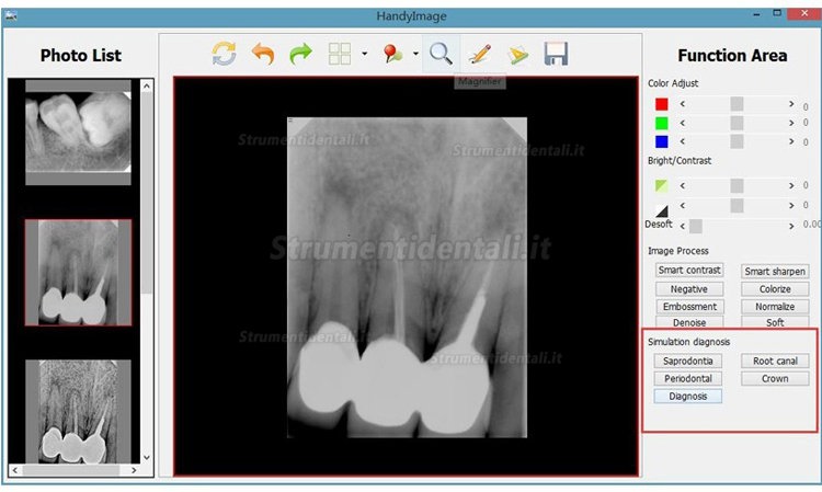 Dentale Radiografia Endorale Portatile II + Handy HDR 500/600 Dentale Sensori Endorali