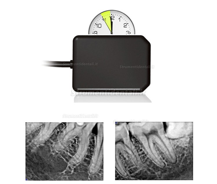 Dentale Radiografia Endorale Portatile II + Handy HDR 500/600 Dentale Sensori Endorali