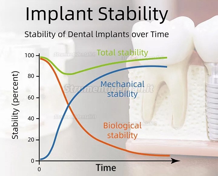 YAHOPE iCHECK ISQ misuratore stabilità implantare dispositivo di misurazione della stabilità dell'impianto YAHOPE iCHECK ISQ misuratore stabilità implantare dispositivo di misurazione della stabilità dell'impianto