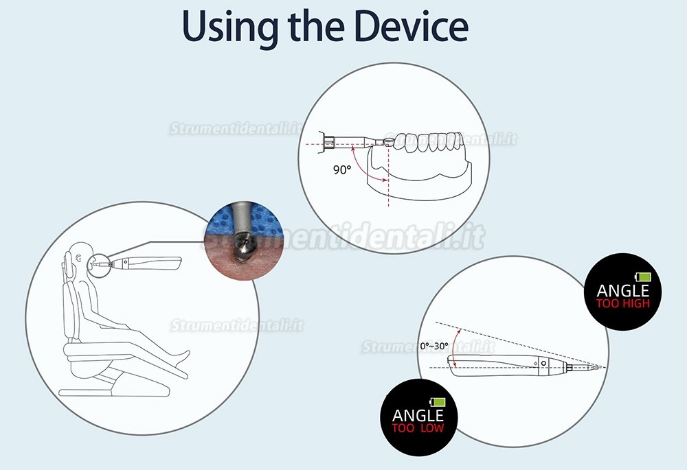 YAHOPE iCHECK ISQ misuratore stabilità implantare dispositivo di misurazione della stabilità dell'impianto YAHOPE iCHECK ISQ misuratore stabilità implantare dispositivo di misurazione della stabilità dell'impianto