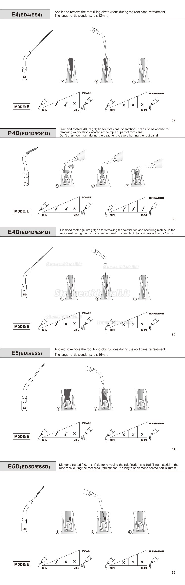 5Pz Refine® Inserti piezo per endodonzia E1 E2 E3 E4 E4 E6 E7 E8 E9 E10 E11 E14 E15 compatible con EMS MECTRON WOODPECKER