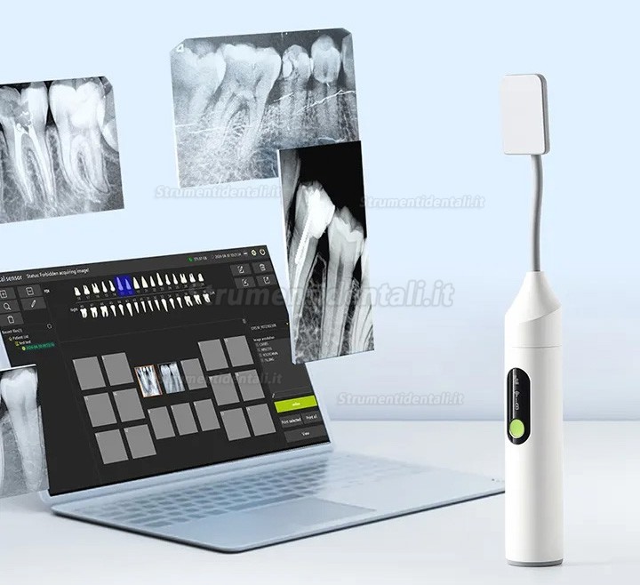 Radiografico endorale mobilen (schermo incorporato) + Sensore rvg dentale iRay Pluto 0002XW Radiografico endorale mobilen (schermo incorporato) + Sensore rvg dentale iRay Pluto 0002XW