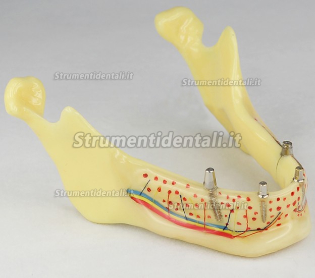 Modello protesi invisibile dentale M-2014b
